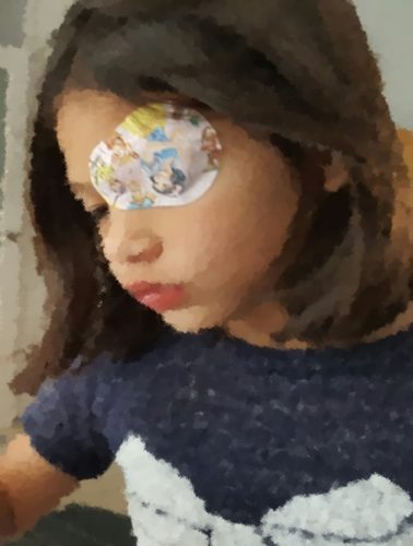 eyepatch